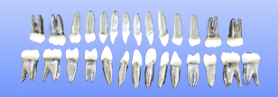 <b>金属根树脂冠恒牙模型</b>