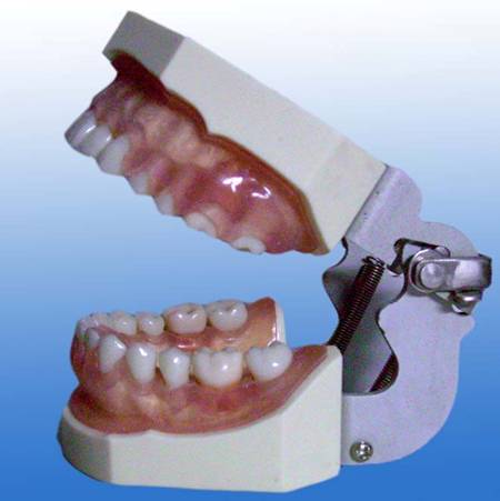 <b>牙龈病模型</b>
