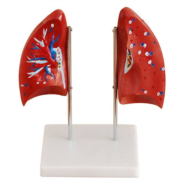 <b>肺解剖模型</b>
