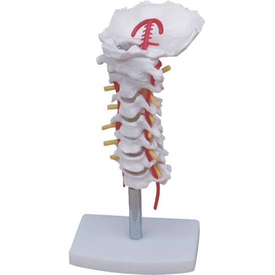 <b>颈椎带颈动脉、后枕骨、椎间盘与神经模型</b>